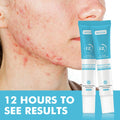 Gel Anti-Acné de Acción Rápida con Ácido Salicílico (20g)