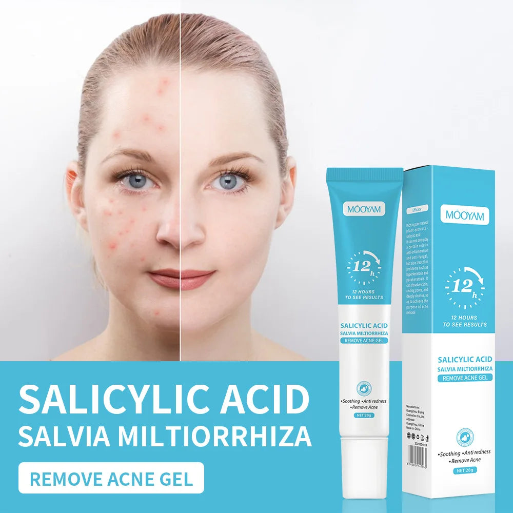 Gel Anti-Acné de Acción Rápida con Ácido Salicílico (20g)